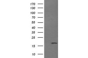 Image no. 1 for anti-Cancer/testis Antigen 1B (CTAG1B) antibody (ABIN1499902) (CTAG1B Antikörper)
