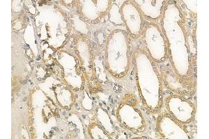 ABIN6259275 and ABIN6273382 at 1/100 staining human normal kidney tissue by IHC-P. (PDHA2 Antikörper  (C-Term))