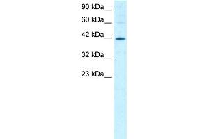 WB Suggested Anti-MIER1 Antibody Titration:  1. (MIER1 Antikörper  (Middle Region))