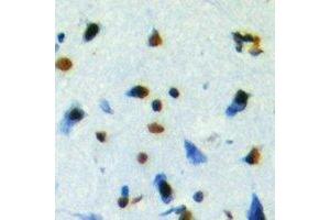 Immunohistochemistry (IHC) image for anti-NUDC antibody (ABIN7308104)