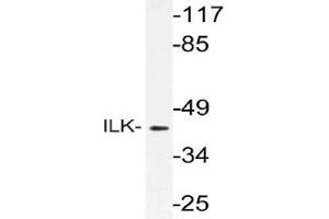 Western blot (WB) analysis of ILK antibody in extracts from rat liver cells.