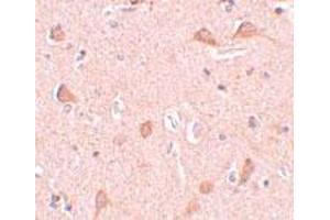 Immunohistochemical staining of human brain tissue with 5 ug/mL SIPA1L1 polyclonal antibody . (SIPA1L1 Antikörper  (N-Term))