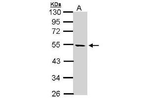WB Image Sample (30 ug of whole cell lysate) A: Hela S3 10% SDS PAGE antibody diluted at 1:1000 (STK25 Antikörper)