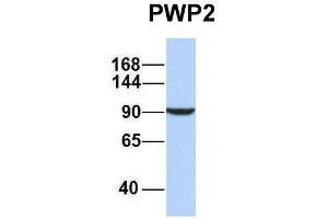 Host:  Rabbit  Target Name:  PWP2  Sample Type:  MCF7  Antibody Dilution:  1. (PWP2 Antikörper  (Middle Region))