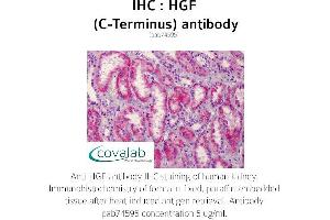 Image no. 1 for anti-Hepatocyte Growth Factor (Hepapoietin A, Scatter Factor) (HGF) (C-Term) antibody (ABIN5693598)