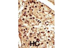 Immunohistochemistry (IHC) image for anti-Transient Receptor Potential Cation Channel, Subfamily M, Member 7 (TRPM7) antibody (ABIN2995271) (TRPM7 Antikörper)