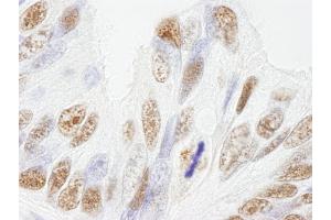 Immunohistochemistry (IHC) image for anti-Nuclear Mitotic Apparatus Protein 1 (NUMA1) (AA 900-950) antibody (ABIN7448994) (NUMA1 Antikörper  (AA 900-950))