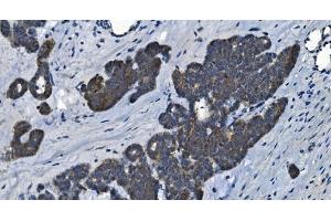 IHC analysis of MAP4K5 using anti-MAP4K5 antibody (ABIN7603181). (MAP4K5 Antikörper  (N-Term))