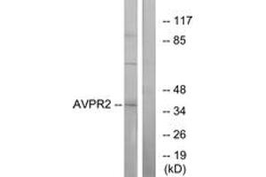 Western blot analysis of extracts from RAW264. (AVPR2 Antikörper  (AA 72-121))