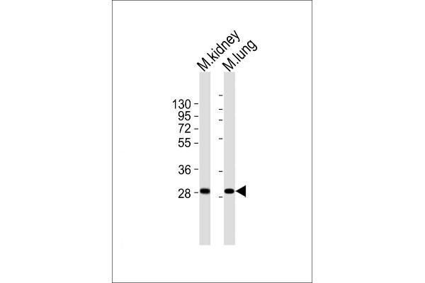 HOXB4 Antikörper  (C-Term)