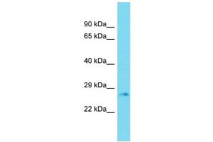 Host: Rabbit Target Name: PLD6 Sample Type: Fetal Heart lysates Antibody Dilution: 1. (PLD6 Antikörper  (C-Term))