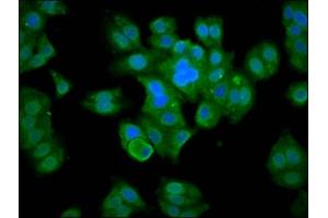 Immunofluorescence staining of HepG2 cells with ABIN7160361 at 1:133, counter-stained with DAPI. (MBNL3 Antikörper  (AA 116-211))