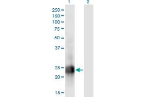 Western Blot analysis of MID1IP1 expression in transfected 293T cell line by MID1IP1 monoclonal antibody (M01), clone 8G8. (m1ip1 Antikörper  (AA 1-183))