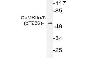 Western blot (WB) analyzes of p-CaMKIIalpha/delta antibody in extracts from K562 cells. (CAMK2A Antikörper  (pThr286))