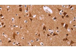 Immunohistochemistry of paraffin-embedded Human brain tissue using ART5 Polyclonal Antibody at dilution 1:50