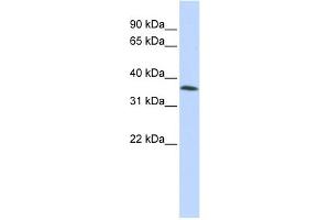 WB Suggested Anti-C8orf70 Antibody Titration:  0. (FAM164A Antikörper  (Middle Region))