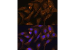 Immunohistochemistry of paraffin-embedded mouse kidney using SHMT1 antibody (ABIN6132654, ABIN6147744, ABIN6147746 and ABIN6216135) at dilution of 1:100 (40x lens). (SHMT1 Antikörper  (AA 285-444))