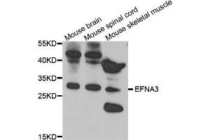 Western Blotting (WB) image for anti-Ephrin A3 (EFNA3) (AA 23-214) antibody (ABIN3016534) (Ephrin A3 Antikörper  (AA 23-214))