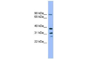 WB Suggested Anti-LHPP Antibody Titration: 0. (LHPP Antikörper  (Middle Region))