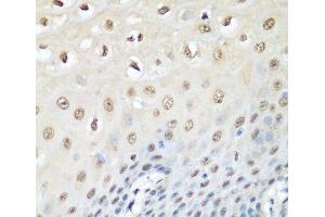 Immunohistochemistry of paraffin-embedded Human esophagus using VCP Polyclonal Antibody at dilution of 1:200 (40x lens). (VCP Antikörper)