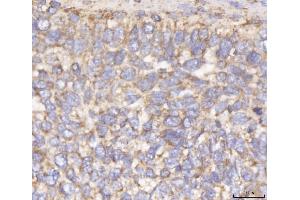 IHC analysis of DLST using anti-DLST antibody (ABIN7599412). (DLST Antikörper  (AA 1-453))