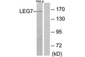 Western blot analysis of extracts from HeLa cells, using LEG7 Antibody. (LGALS7 Antikörper  (AA 41-90))
