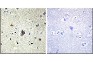 Immunohistochemistry (IHC) image for anti-Collagen, Type IV, alpha 3 (COL4A3) (AA 801-850) antibody (ABIN2889912) (COL4a3 Antikörper  (AA 801-850))