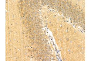 Phospho-EPRS (Ser886) Antibody at 1/100 staining Rat brain tissue by IHC-P. (EPRS Antikörper  (pSer886))