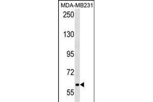 TRPC4 Antibody (N-term) 18682a western blot analysis in MDA-M cell line lysates (35 μg/lane). (TRPC4AP Antikörper  (N-Term))