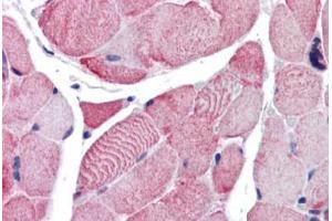 Human Skeletal Muscle (formalin-fixed, paraffin-embedded) stained with ACTB antibody ABIN337375 at 10 ug/ml followed by biotinylated goat anti-rabbit IgG secondary antibody ABIN481713, alkaline phosphatase-streptavidin and chromogen. (beta Actin Antikörper  (C-Term))