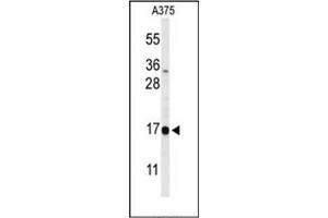 Western blot analysis of DAZAP2 Antibody (C-term) in A375 cell line lysates (35ug/lane). (DAZAP2 Antikörper  (C-Term))