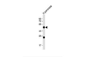 Anti-NPTX2 (C-term) at 1:1000 dilution + H. (NPTX2 Antikörper  (C-Term))