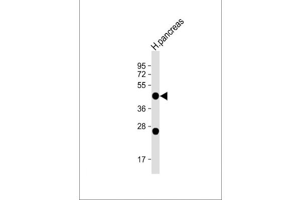 NPTX2 Antikörper  (C-Term)