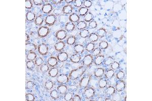 Immunohistochemistry (IHC) image for anti-Mitochondrially Encoded NADH Dehydrogenase 1 (MT-ND1) antibody (ABIN7268598)