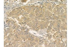 ABIN6259213 and ABIN6273534 at 1/100 staining human normal kidney tissue by IHC-P.