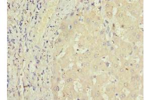 Immunohistochemistry of paraffin-embedded human liver tissue using ABIN7164457 at dilution of 1:100 (GPR146 Antikörper  (AA 301-333))