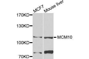 Western blot analysis of extracts of MCF7 and mouse liver cells, using MCM10 antibody. (MCM10 Antikörper)