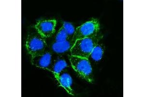 IF analysis of LSR using anti-LSR antibody (ABIN7599514). (LSR Antikörper  (AA 1-649))