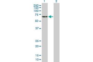 Western Blot analysis of TBCD expression in transfected 293T cell line by TBCD MaxPab polyclonal antibody. (TBCD Antikörper  (AA 1-623))