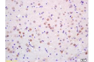 Formalin-fixed and paraffin embedded rat brain labeled with Rabbit Anti CDC10/Septin 7 Polyclonal Antibody, Unconjugated (ABIN873015) at 1:200 followed by conjugation to the secondary antibody and DAB staining