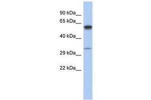 Image no. 1 for anti-Zinc Finger, DHHC-Type Containing 24 (ZDHHC24) (C-Term) antibody (ABIN6743943) (ZDHHC24 Antikörper  (C-Term))