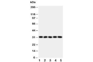 Western blot testing of LOX-1 antibody and Lane 1:  HeLa (OLR1 Antikörper  (N-Term))