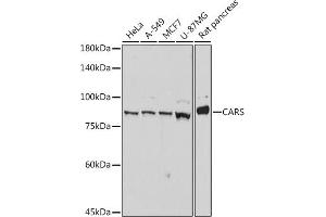 Western blot analysis of extracts of various cell lines, using CARS antibody (ABIN7266624) at 1:1000 dilution. (CARS Antikörper)