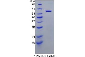 SDS-PAGE (SDS) image for Apolipoprotein A-II (APOA2) (AA 24-100) protein (His tag,GST tag) (ABIN1877597)