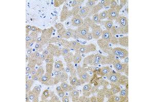 Immunohistochemistry of paraffin-embedded human liver injury using POMGNT1 antibody. (POMGNT1 Antikörper)