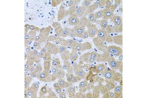 Immunohistochemistry of paraffin-embedded human liver injury using POMGNT1 antibody. (POMGNT1 Antikörper)