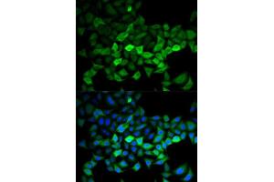 Immunofluorescence analysis of HeLa cells using UBE2C antibody. (UBE2C Antikörper  (AA 1-179))