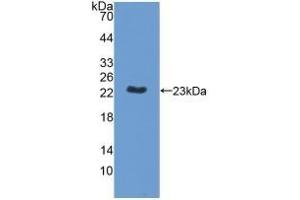 Detection of Recombinant MPP6, Human using Polyclonal Antibody to Membrane Protein, Palmitoylated 6 (MPP6) (MPP6 Antikörper  (AA 331-503))