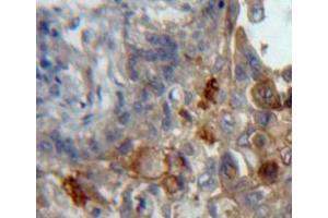Used in DAB staining on fromalin fixed paraffin-embedded lung tissue (Podoplanin Antikörper  (AA 23-143))