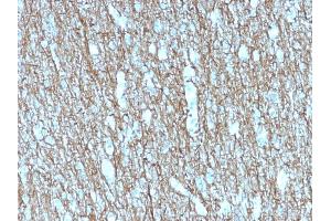 Formalin-fixed, paraffin-embedded human Brain stained with Neurofilament Mouse Recombinant Monoclonal Antibody (rNF421).